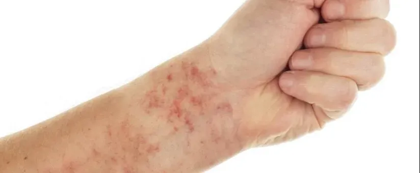 badania diagnostyczne b&oacute;l kości swędzenie sk&oacute;ry