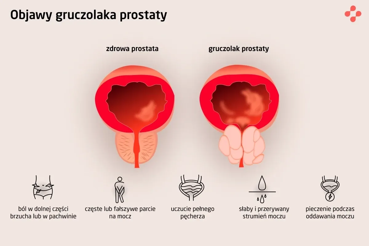 Leczenie powiększonej prostaty u psa