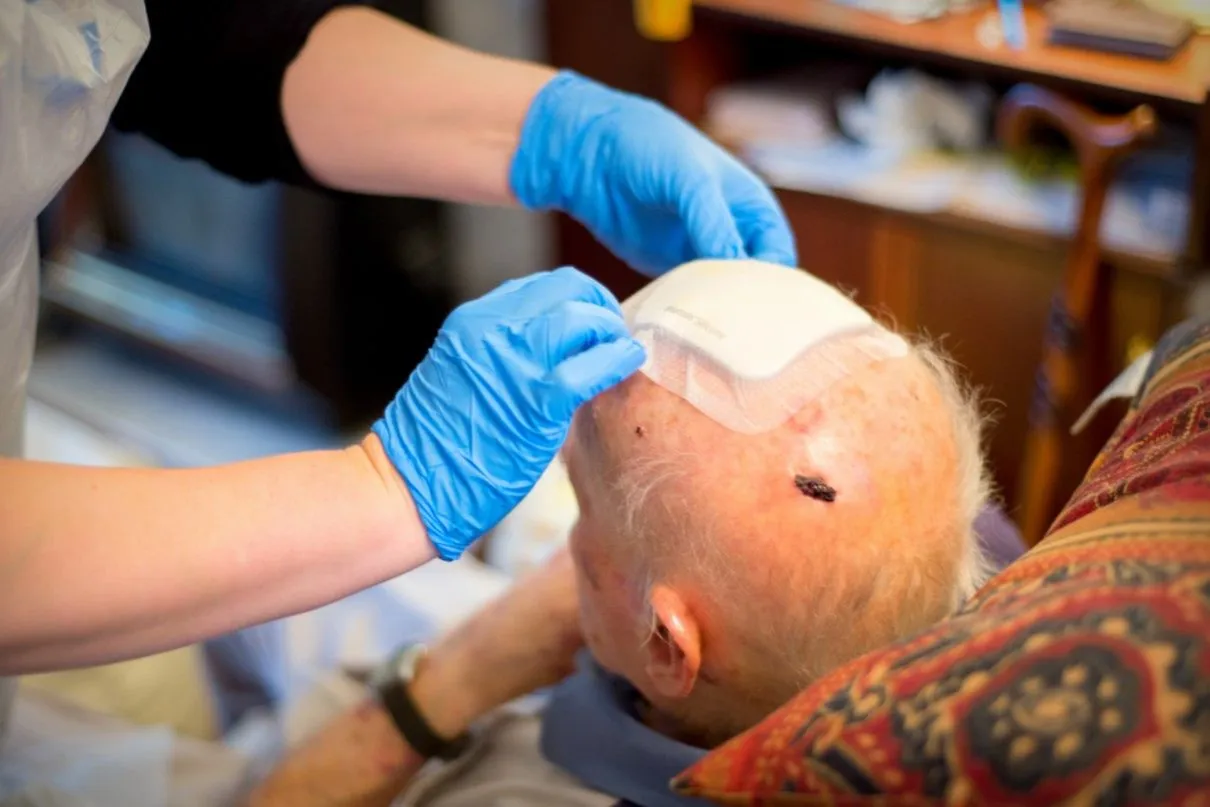 Opatrunek na głowie po mocnym uderzeniu w głowę. Ręce w niebieskich rękawiczkach zakładają opatrunek.