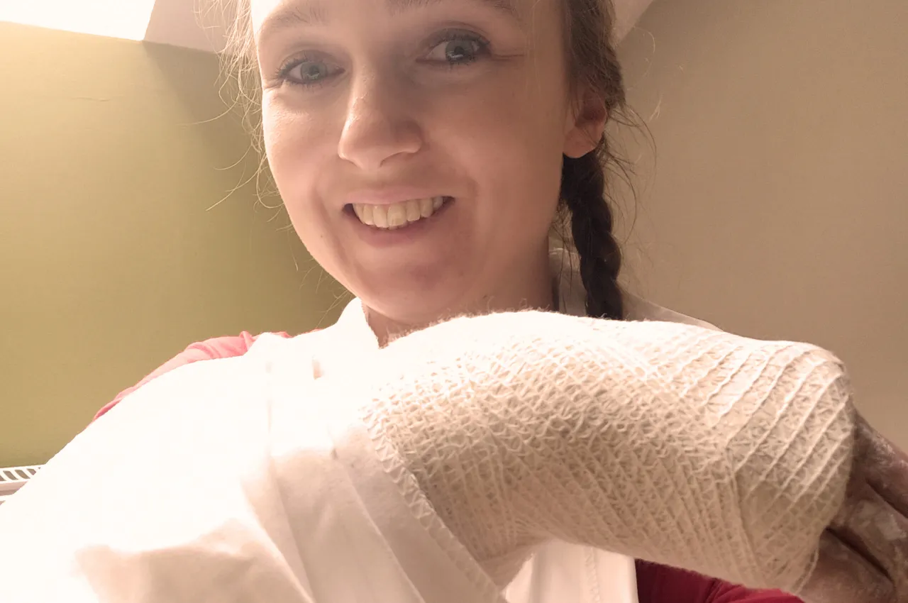 Uśmiechnięta kobieta z ręką w bandażu po złamaniu nasady dalszej kości promieniowej, oczekująca na odszkodowanie PZU.