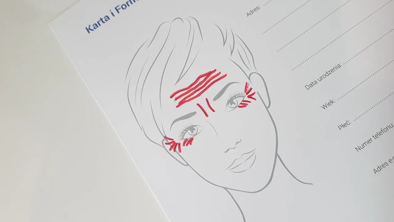 cennik botoksu warszawa schemat twarzy