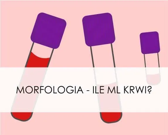 Zdjęcie Ile zupy na osobę? Oto, jak uniknąć za małych porcji
