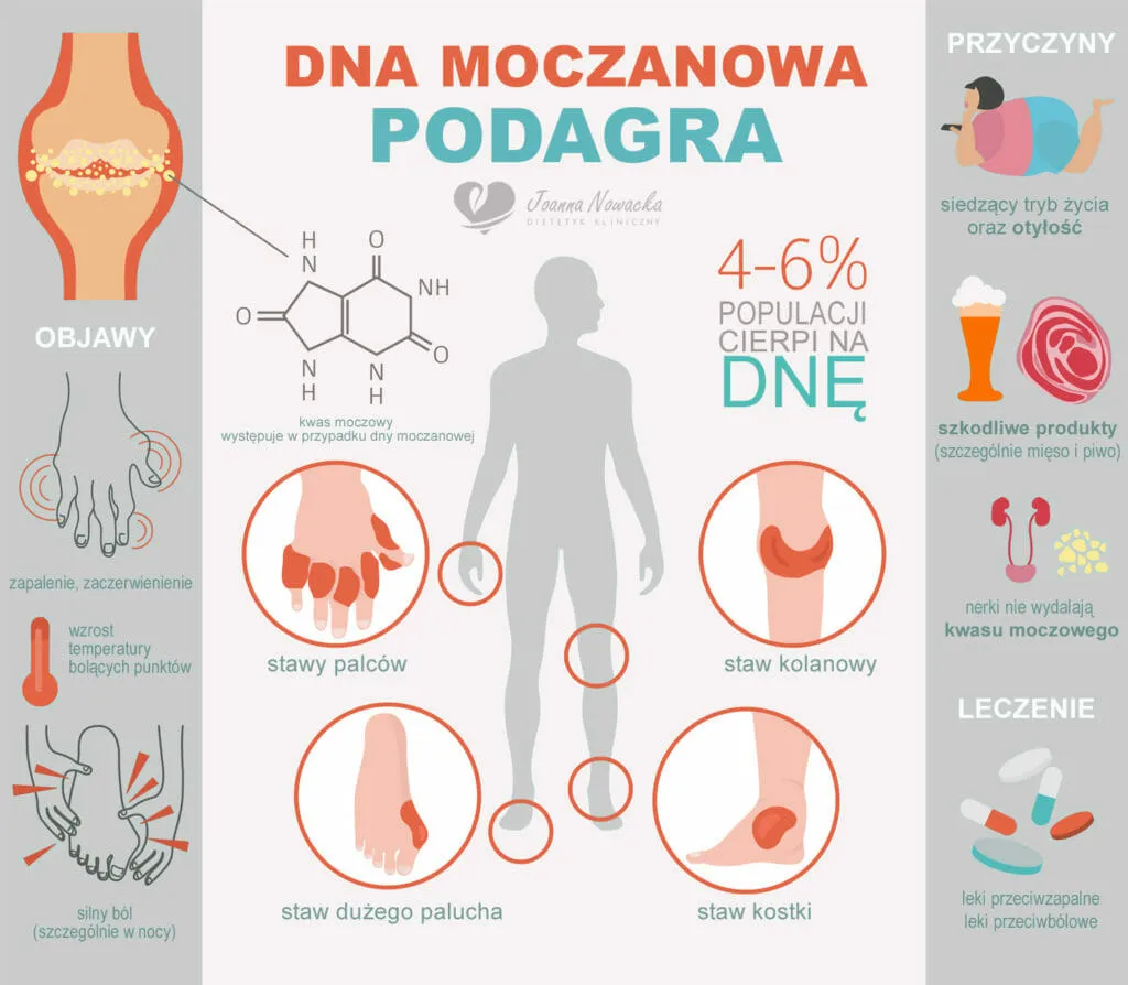 Zdjęcie Podwyższony poziom kwasu moczowego: skuteczne sposoby leczenia w domu