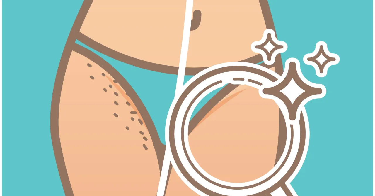 Zdjęcie Jak wydepilować bikini skutecznie i bez podrażnień? Sprawdź metody