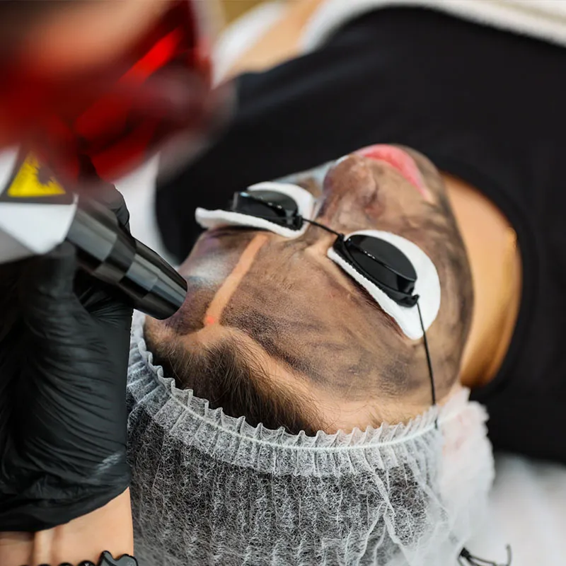 Zdjęcie Peeling węglowy: 7 korzyści dla skóry, o których nie wiedziałeś