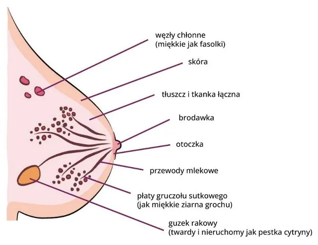 Zdjęcie Jak szybko rośnie guz w piersiach? Co wpływa na tempo rozwoju nowotworu