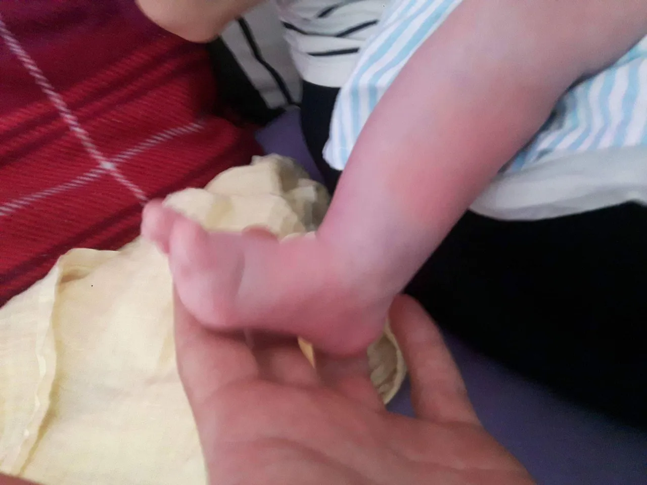 Zdjęcie Czerwone stopy u niemowlaka: przyczyny i sposoby leczenia