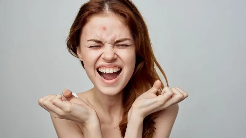 Zdjęcie Jak pozbyć się pryszczy? Sprawdzone metody i porady ekspertów