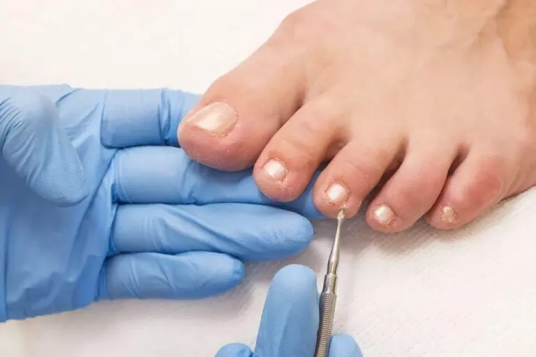 Zdjęcie Kto to lekarz od paznokci? Zrozum, kogo potrzebujesz dla zdrowia paznokci