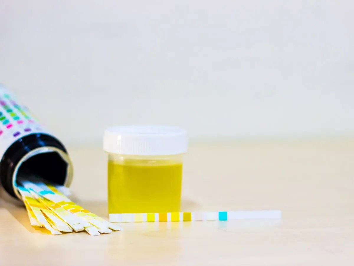 Przechowywanie pr&oacute;bki moczu w lod&oacute;wce