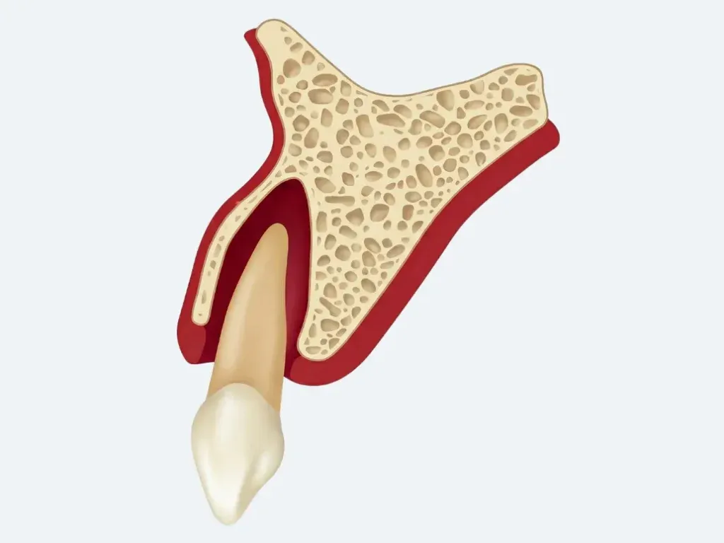 zwichnięcie zęba objawy por&oacute;wnanie