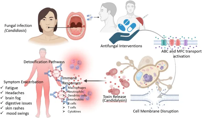 Candida Die-Off Linderung Ma&szlig;nahmen
