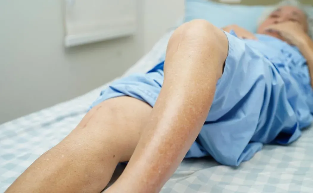 Zdjęcie Ile kosztuje rehabilitacja kolana? Ceny i lokalizacje, które zaskakują