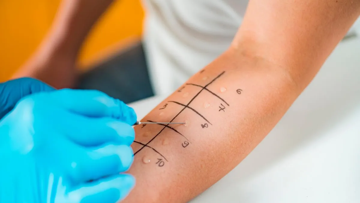 Testy alergiczne na marihuanę