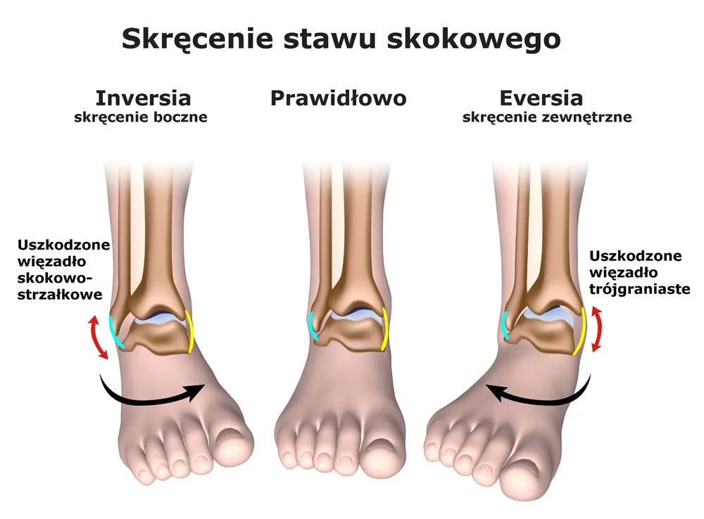 mechanizm skręcenia kostki inwersja ewersja