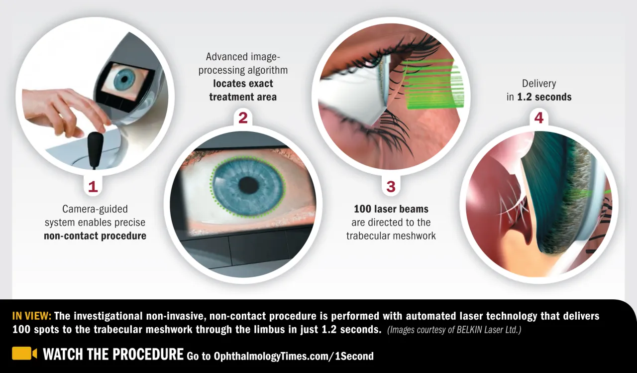 Metody leczenia jaskry porównanie