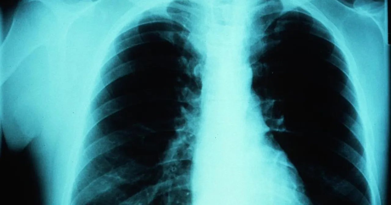 Bezpieczeństwo radiologiczne w Polsce