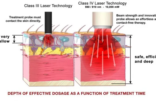 schemat działania lasera w kom&oacute;rce rehabilitacja