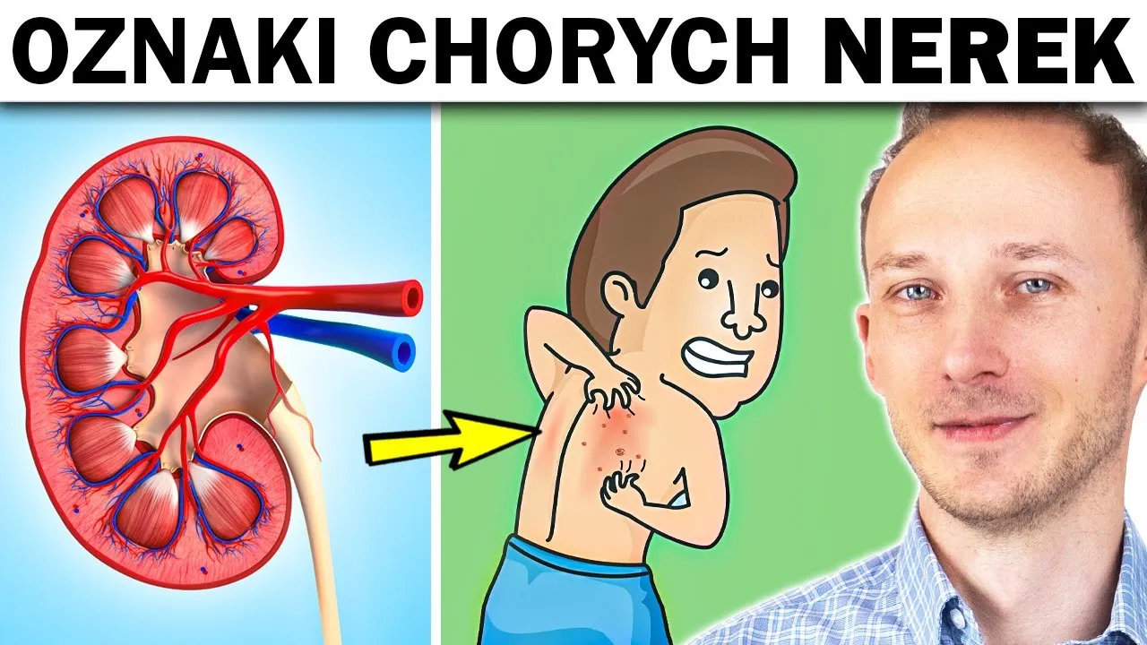 wczesne objawy chorób nerek zmęczenie
