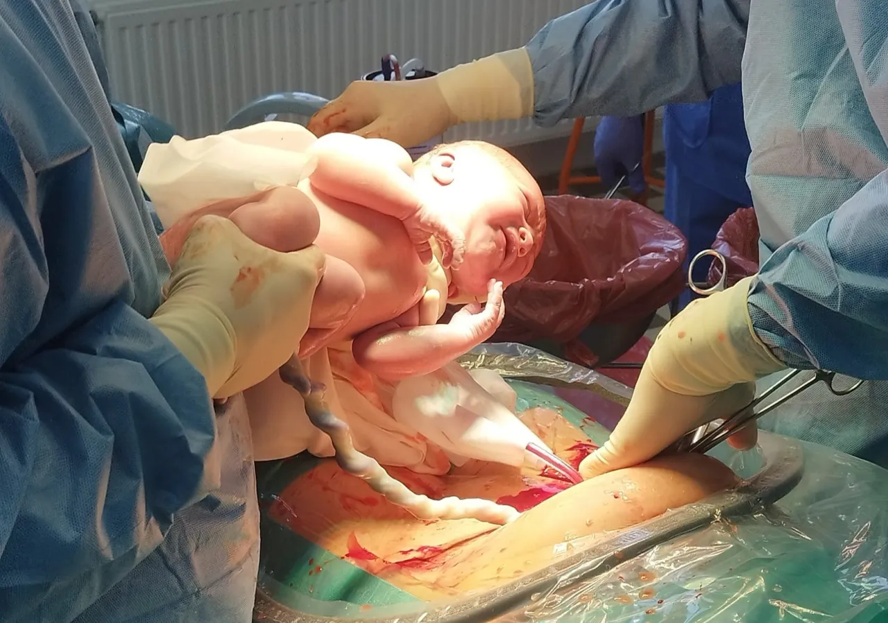 Ilustracja macicy z blizną po cesarskim cięciu