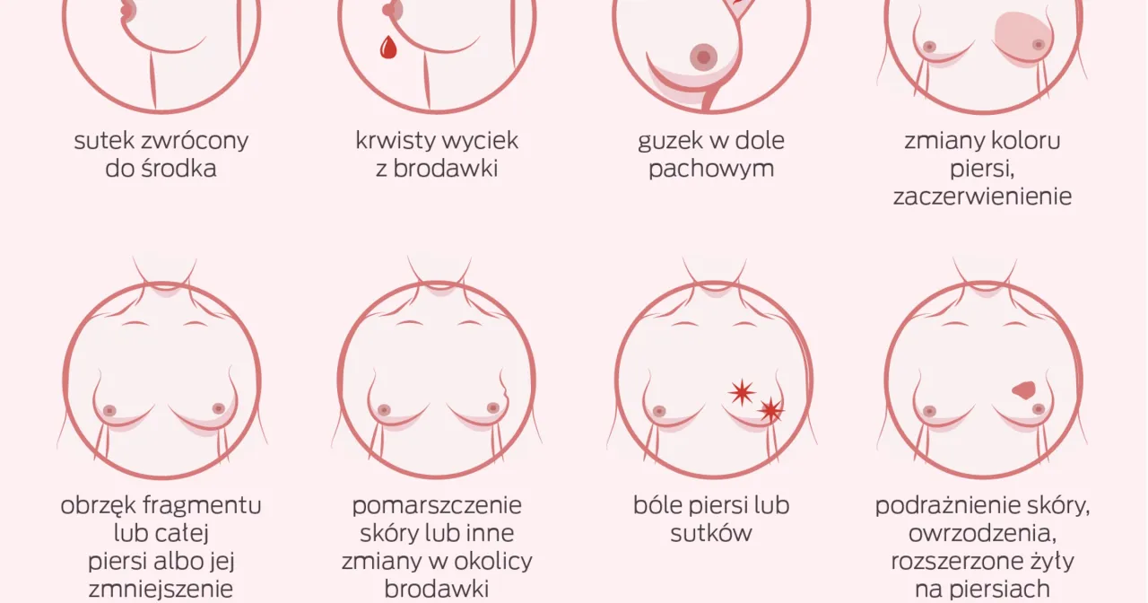 r&oacute;żne objawy raka piersi infografika