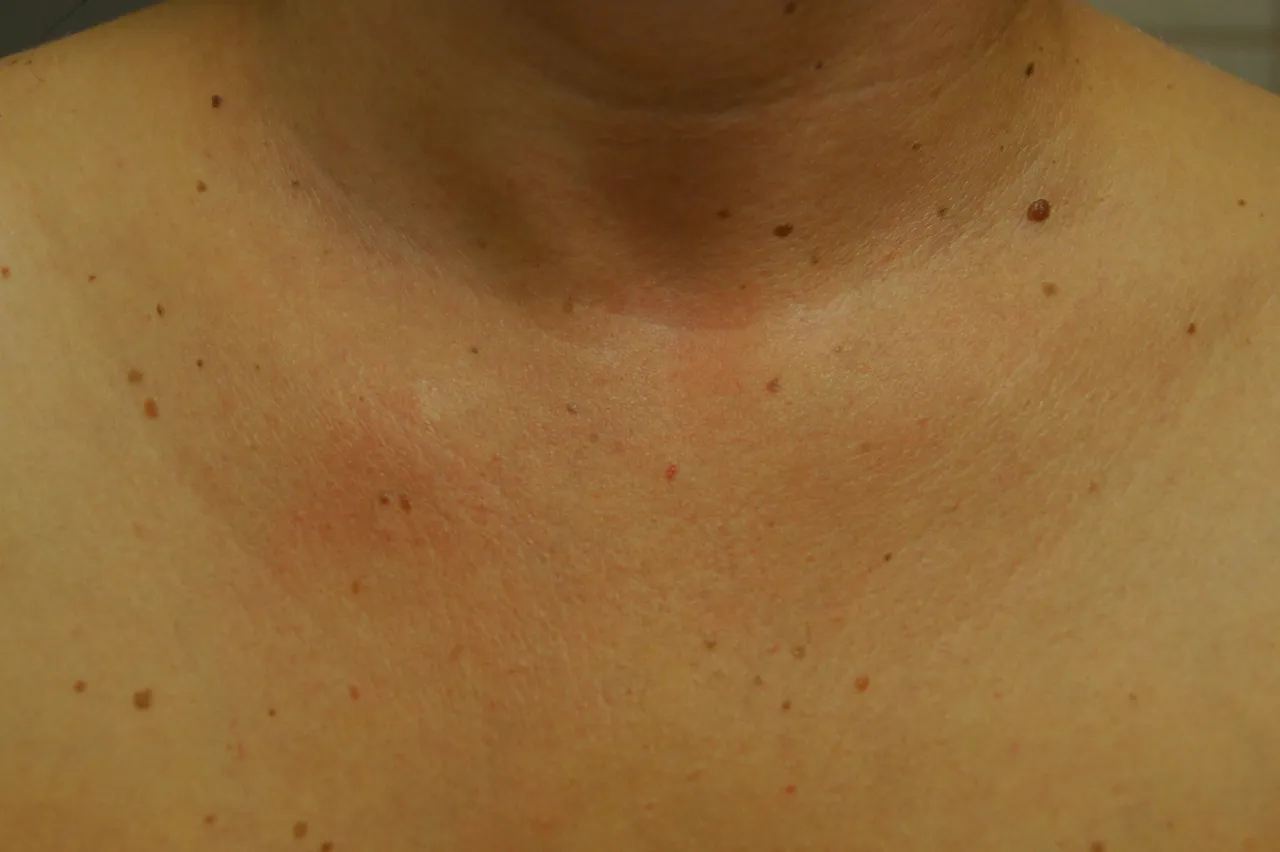 przed i po zabiegi naszyjnik wenus