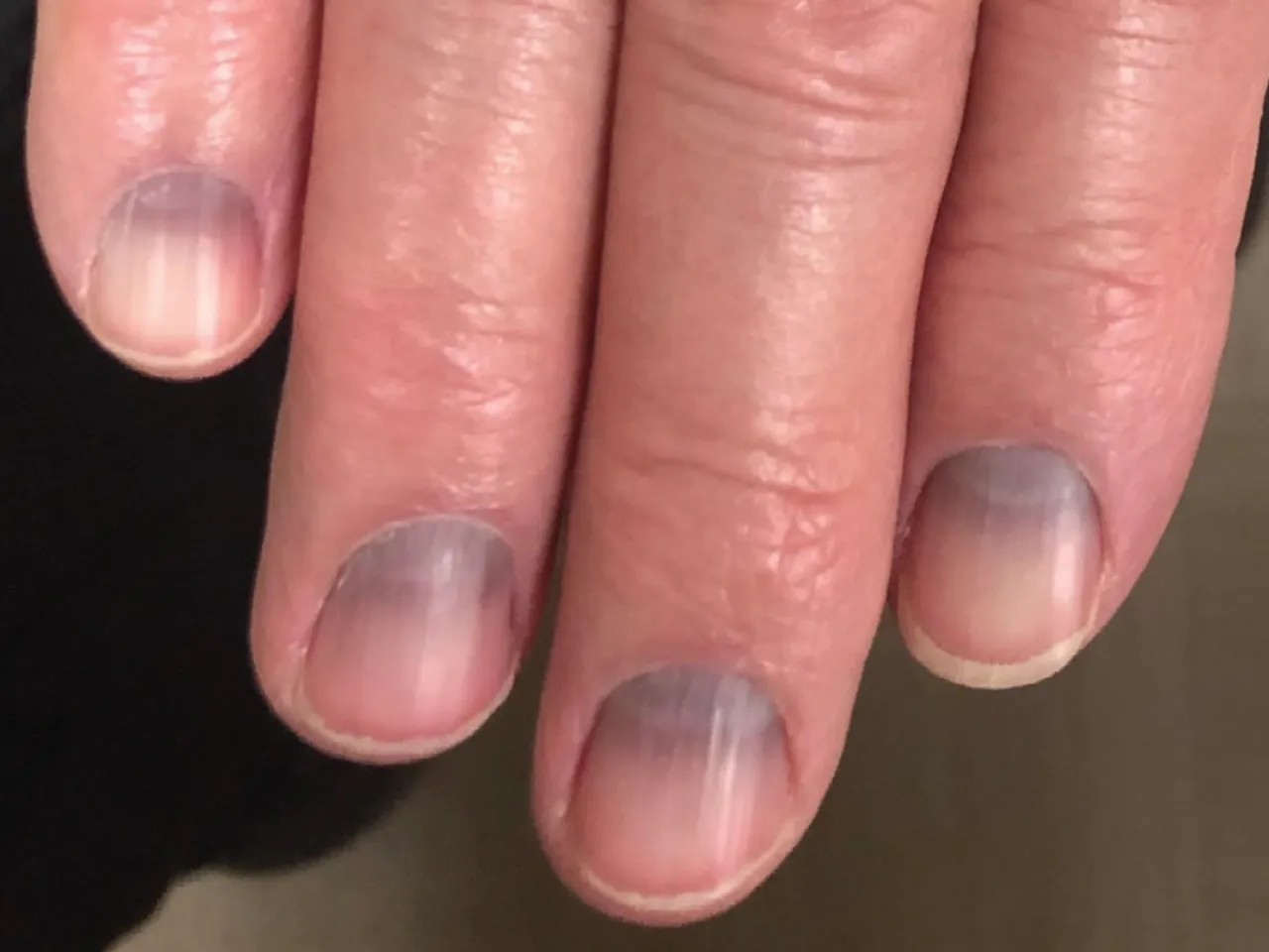 Blaue Fingern&auml;gel K&auml;lte