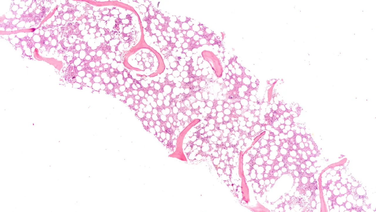 Ilustracja szpiku kostnego i płytek krwi
