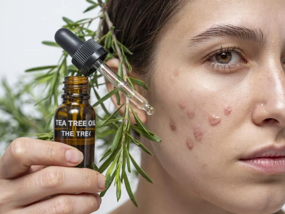 Domowe sposoby na pryszcze, olejek z drzewa herbacianego, zielona glinka, lód na twarz