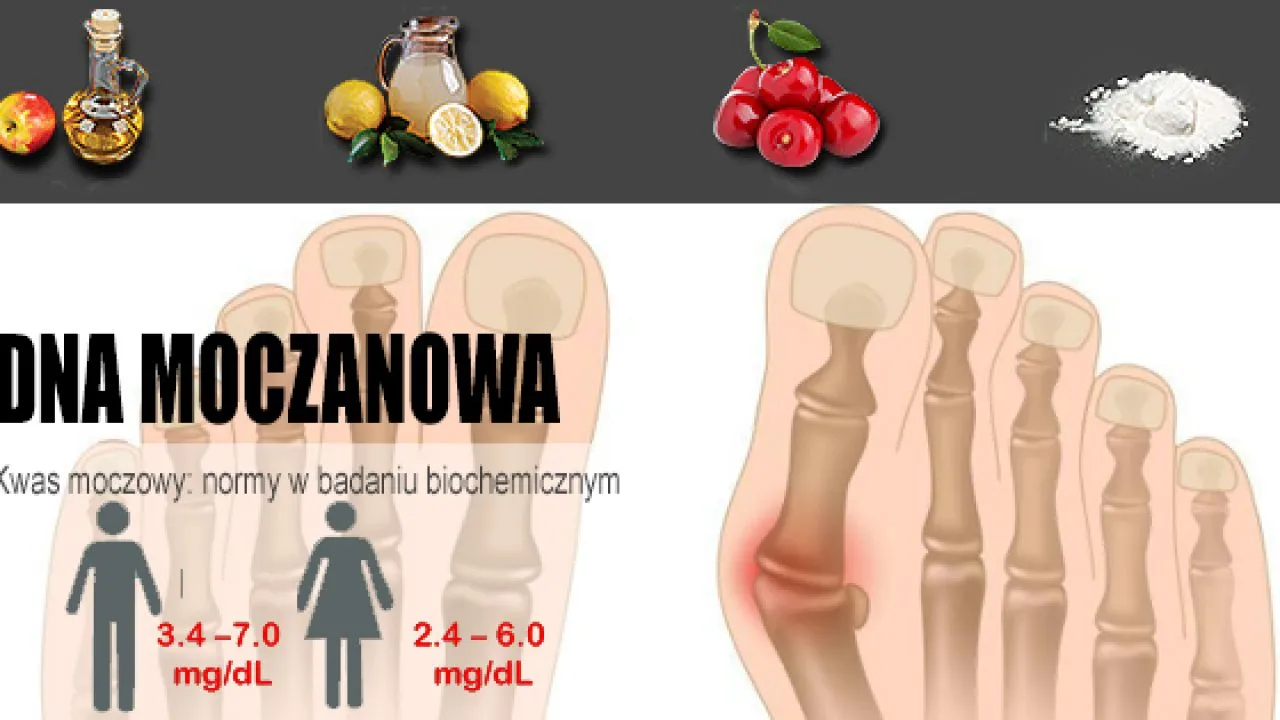 Zdjęcie Podwyższony poziom kwasu moczowego przyczyny i jak ich unikać