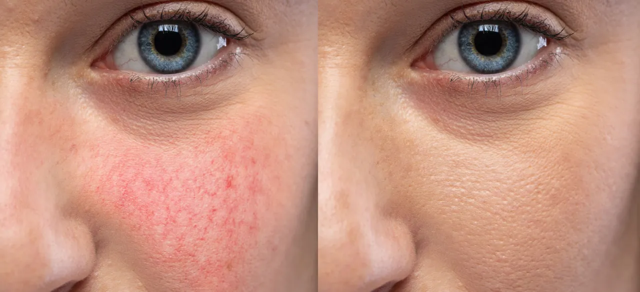 Zdrowa skóra i ogólne samopoczucie