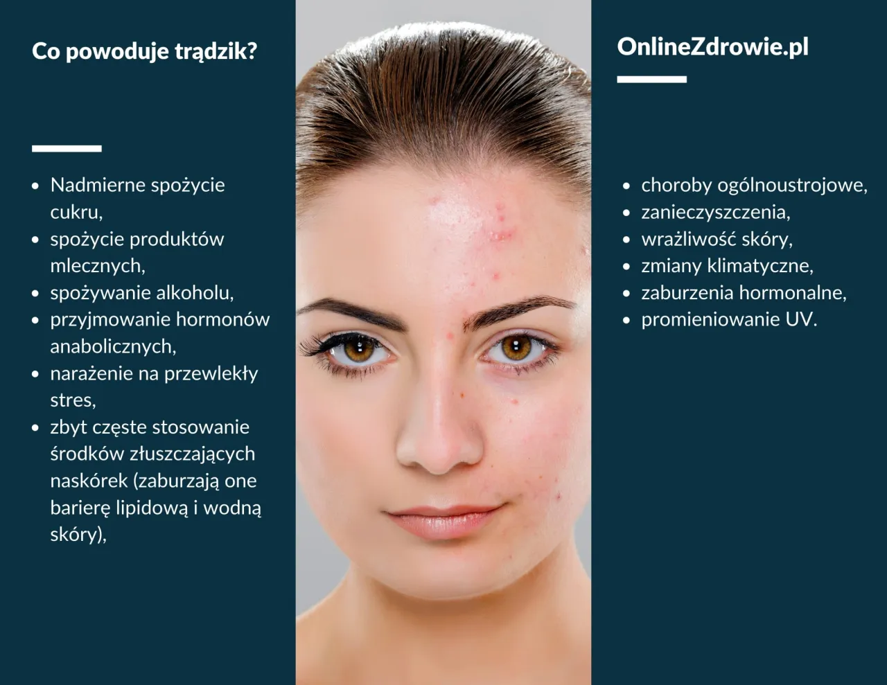 Przyczyny trądziku na policzkach infografika