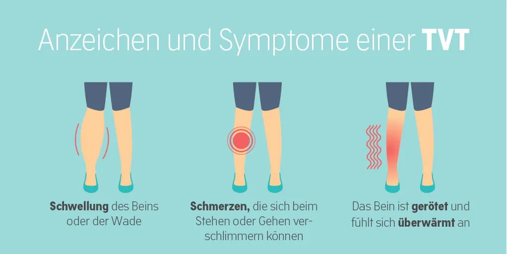 Symptome tiefe Venenthrombose Bein