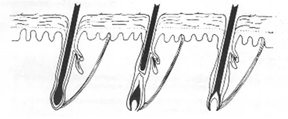 Cykl wzrostu włosa schemat