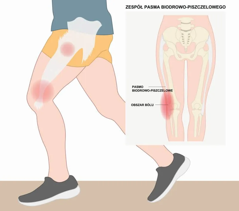 różnica między dobrym a złym bólem w rehabilitacji grafika