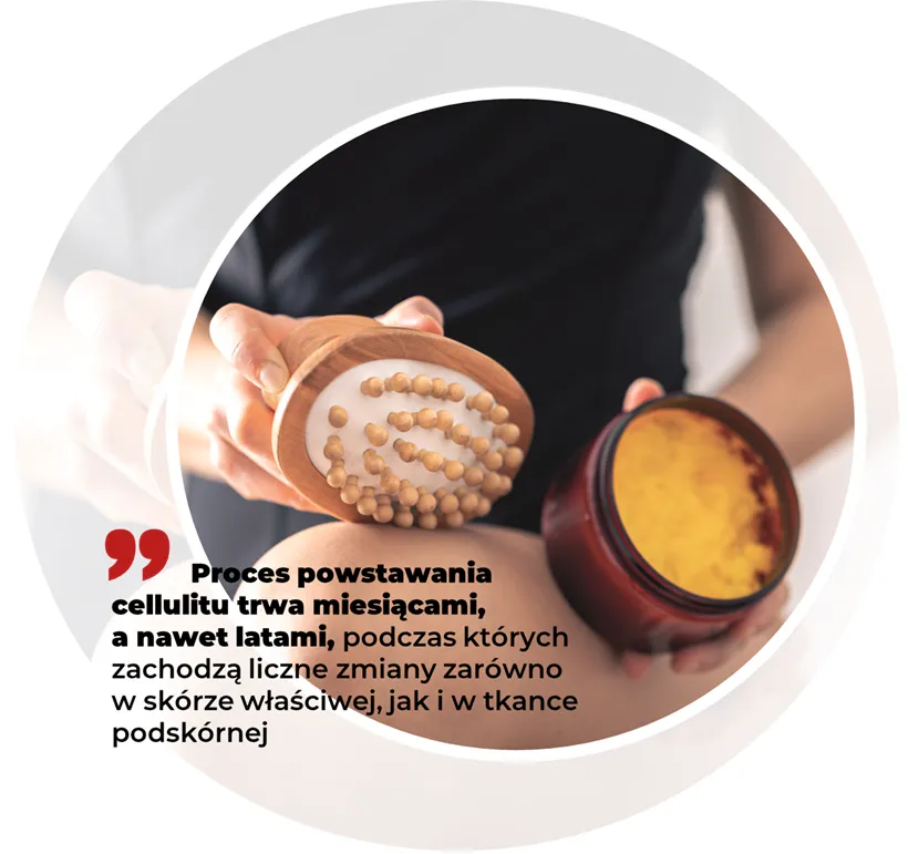 składniki aktywne w kosmetykach antycellulitowych