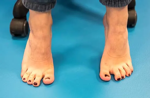 ćwiczenia rehabilitacyjne stopa haluks