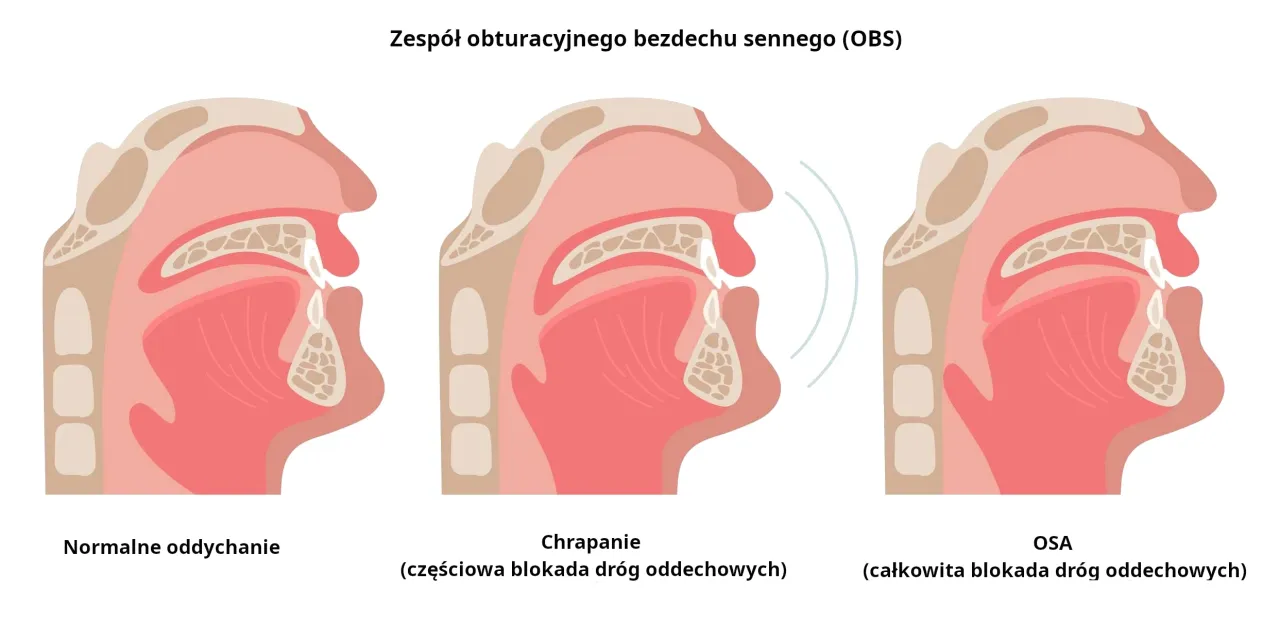 Zdrowy styl życia, sen