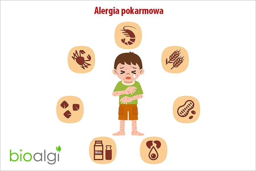 alergia a układ pokarmowy