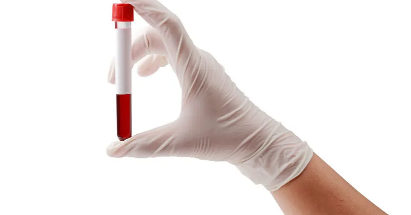 agranulocytoza objawy