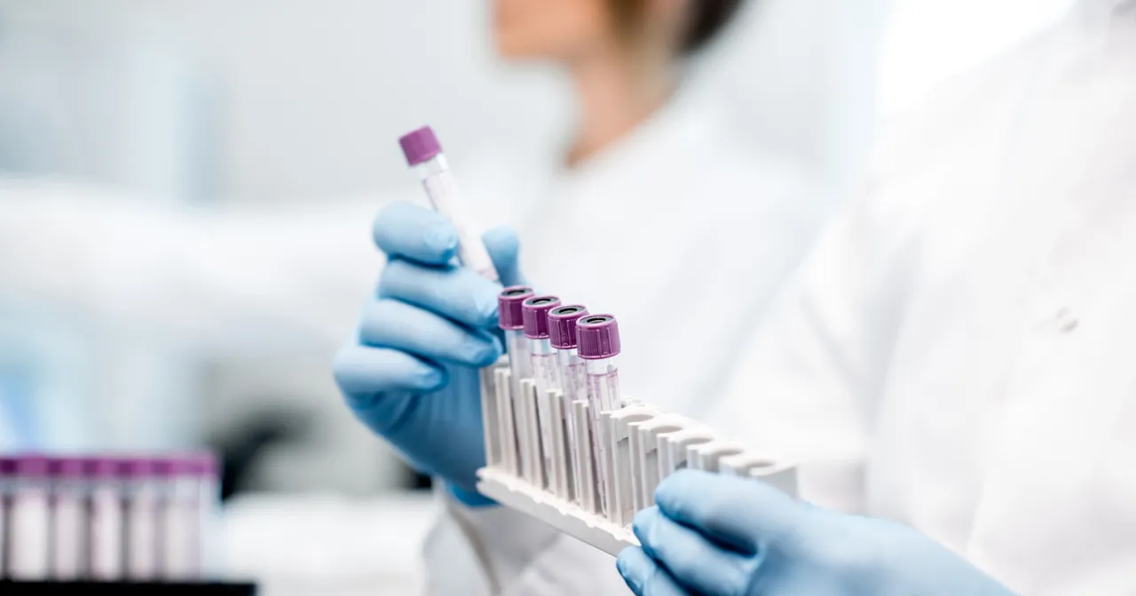 produkty zakazane przed badaniem krwi utajonej w kale