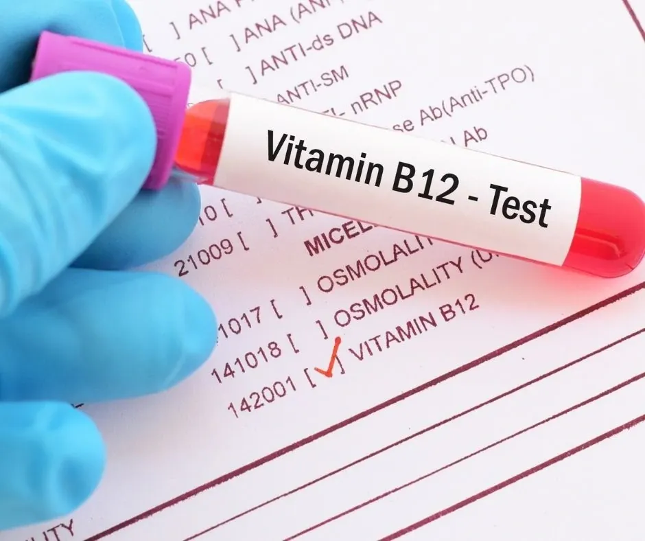 Zdjęcie Jakie suplementy przy Hashimoto mogą poprawić Twoje samopoczucie?