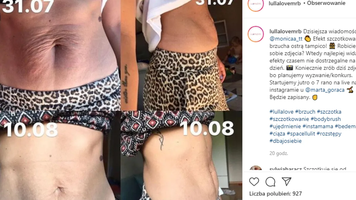 szczotkowanie na sucho przed i po