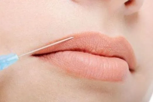 r&oacute;żnica botoks kwas hialuronowy usta grafika