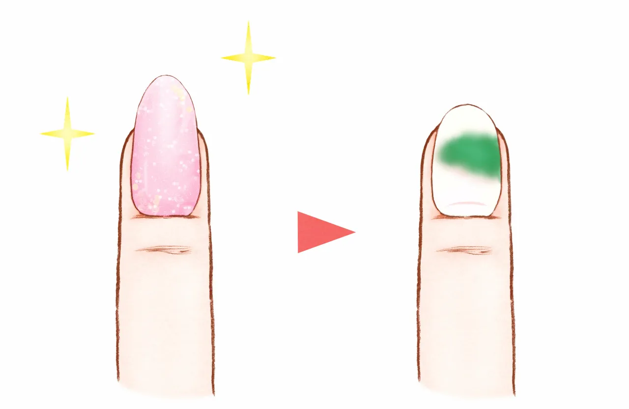 zielona bakteria na paznokciu przed i po malowaniu lakierem hybrydowym