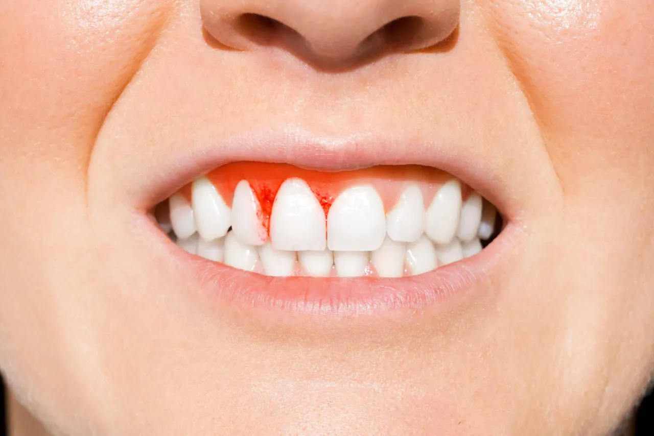 cukrzyca wpływ na zęby