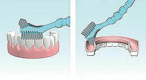 higiena jamy ustnej po protezie