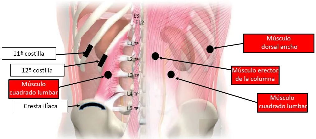 Zdjęcie Todo sobre el músculo cuadrado lumbar: funciones, dolor y soluciones