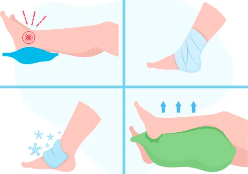 pierwsza pomoc skręcona kostka RICE POLICE