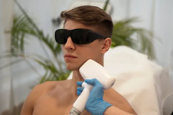 przygotowanie do depilacji laserowej brody